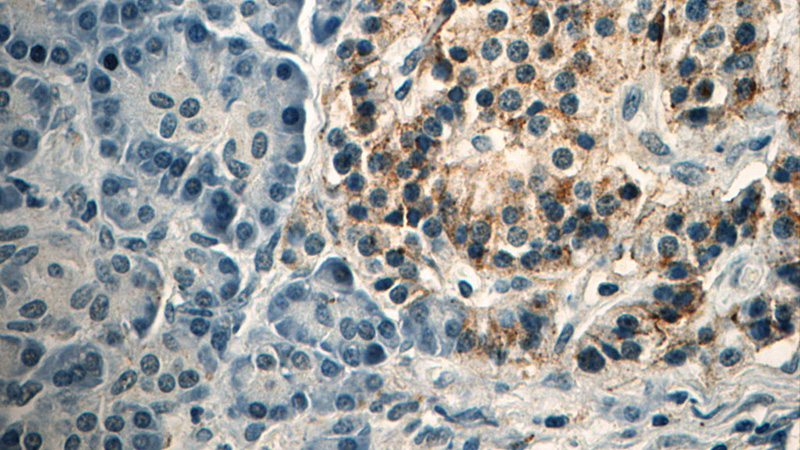 Immunohistochemistry of paraffin-embedded human pancreas tissue slide using Catalog No:107034(Caspase 9 Antibody) at dilution of 1:50 (under 40x lens)