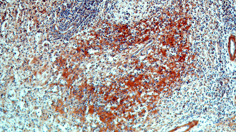 Immunohistochemical of paraffin-embedded human spleen using Catalog No:109429(CNNM3 antibody) at dilution of 1:100 (under 10x lens)