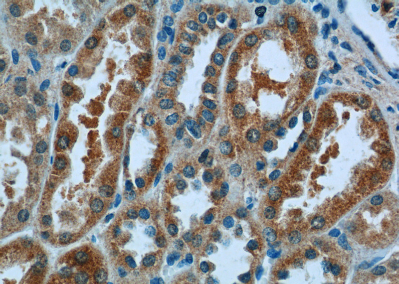 Immunohistochemistry of paraffin-embedded human kidney tissue slide using Catalog No:113007(N4BP3 Antibody) at dilution of 1:50 (under 40x lens)