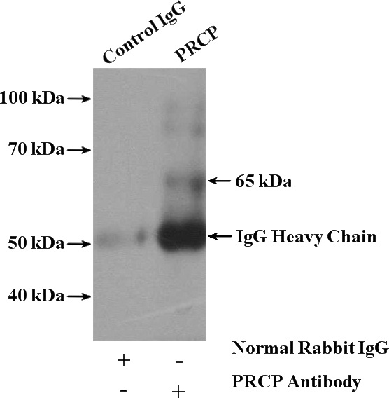 IP Result of anti-PRCP (IP:Catalog No:114171, 4ug; Detection:Catalog No:114171 1:300) with L02 cells lysate 1800ug.