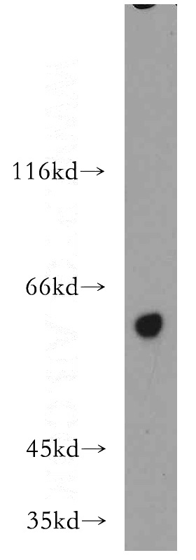HeLa cells were subjected to SDS PAGE followed by western blot with Catalog No:115864(TBC1D22A antibody) at dilution of 1:500