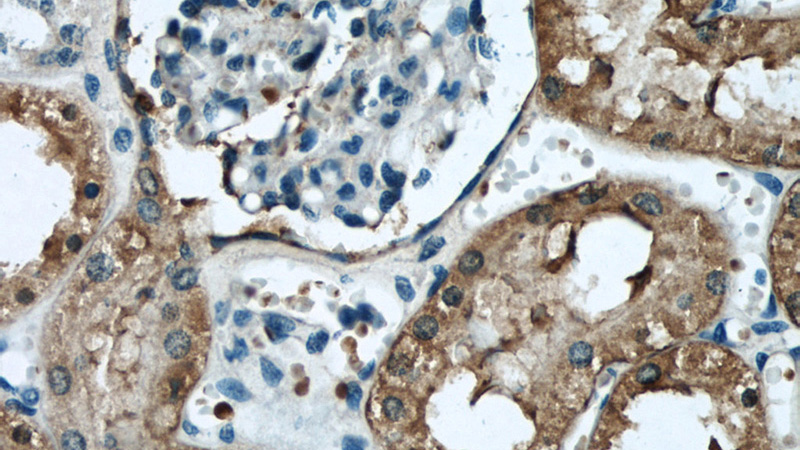 Immunohistochemical of paraffin-embedded human kidney using Catalog No:110785(FTCD antibody) at dilution of 1:50 (under 40x lens)
