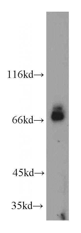 Jurkat cells were subjected to SDS PAGE followed by western blot with Catalog No:108545(BTN2A1 antibody) at dilution of 1:600