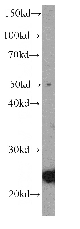PC-3 cells were subjected to SDS PAGE followed by western blot with Catalog No:107035(CAV1 antibody) at dilution of 1:1000