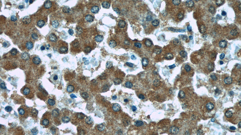 Immunohistochemistry of paraffin-embedded human liver tissue slide using Catalog No:107562(AFM Antibody) at dilution of 1:50