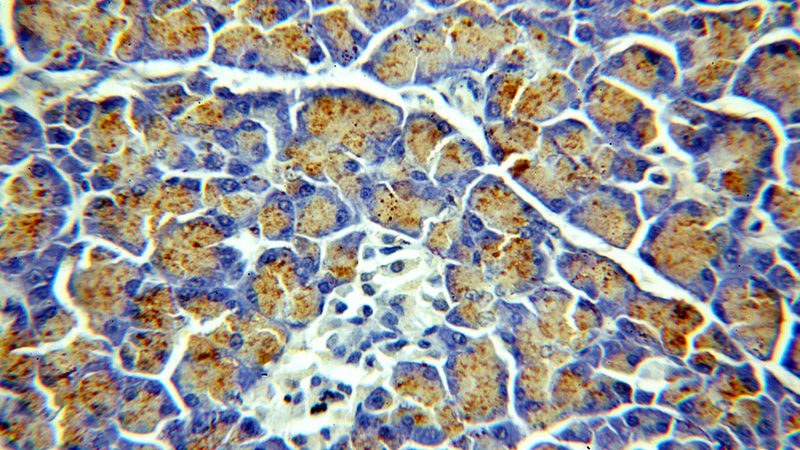 Immunohistochemical of paraffin-embedded human pancreas using Catalog No:109189(CEPT1 antibody) at dilution of 1:50 (under 40x lens)