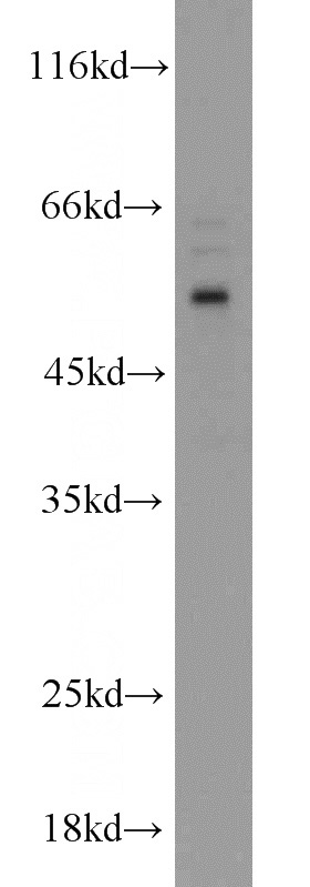 HepG2 cells were subjected to SDS PAGE followed by western blot with Catalog No:112629(MIPOL1 antibody) at dilution of 1:800