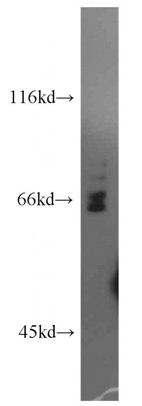 mouse thymus tissue were subjected to SDS PAGE followed by western blot with Catalog No:113888(PIF1 antibody) at dilution of 1:800