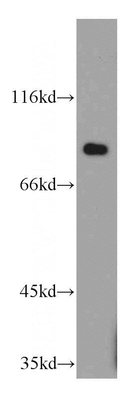 A375 cells were subjected to SDS PAGE followed by western blot with Catalog No:108792(C7orf58 antibody) at dilution of 1:500