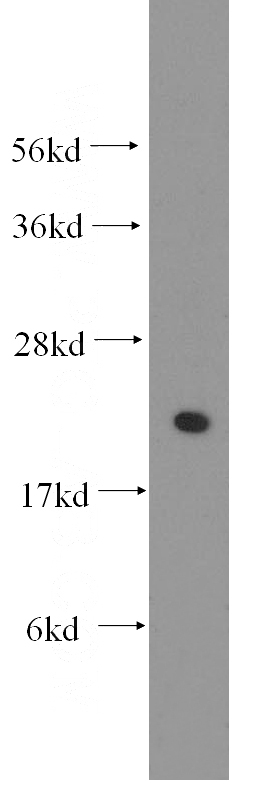 HeLa cells were subjected to SDS PAGE followed by western blot with Catalog No:114813(RPL13 antibody) at dilution of 1:300