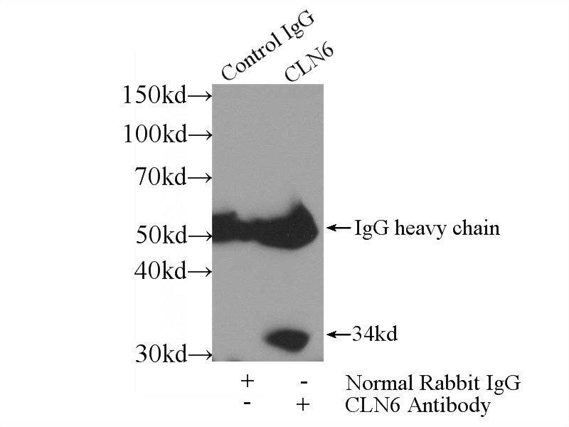 IP Result of anti-CLN6 (IP:Catalog No:109397, 4ug; Detection:Catalog No:109397 1:300) with HEK-293 cells lysate 2560ug.