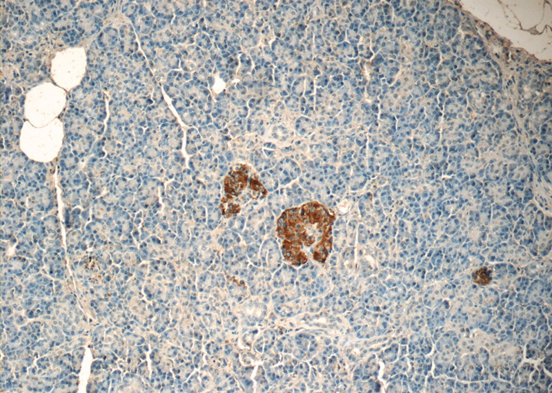 Immunohistochemistry of paraffin-embedded human pancreas tissue slide using Catalog No:108015(Amylin Antibody) at dilution of 1:50 (under 10x lens)