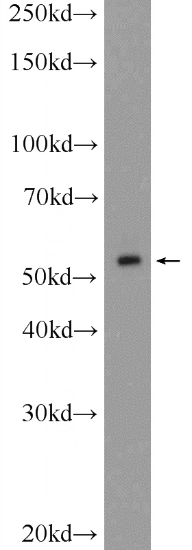 HEK-293 cells were subjected to SDS PAGE followed by western blot with Catalog No:115782(SYNE2 Antibody) at dilution of 1:600