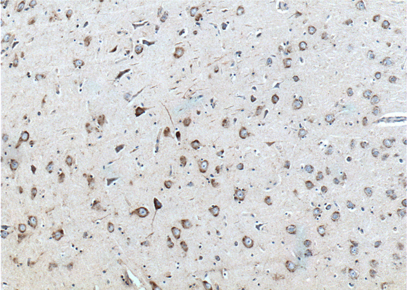 Immunohistochemistry of paraffin-embedded human brain tissue slide using Catalog No:114454(RAB5A-Specific Antibody) at dilution of 1:200 (under 10x lens).