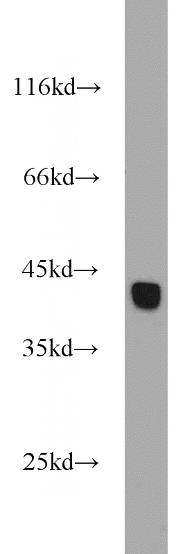 mouse testis tissue were subjected to SDS PAGE followed by western blot with Catalog No:111703(HSPBP1 antibody) at dilution of 1:500