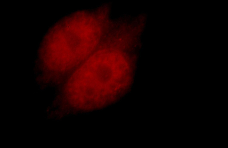 Immunofluorescent analysis of Hela cells, using RXRA antibody Catalog No:114945 at 1:25 dilution and Rhodamine-labeled goat anti-rabbit IgG (red).