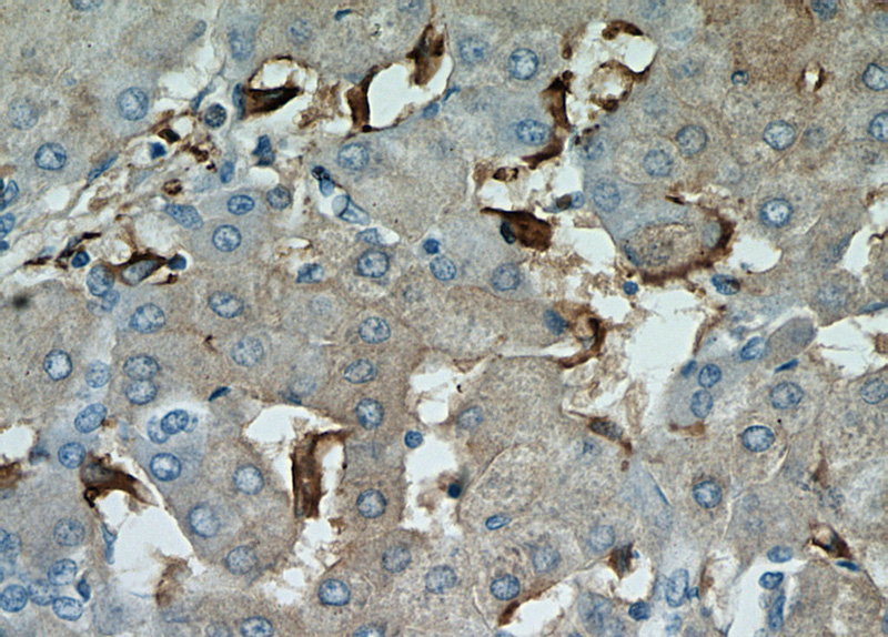 Immunohistochemical of paraffin-embedded human hepatocirrhosis using Catalog No:110429(F4-80 antibody) at dilution of 1:50 (under 40x lens)