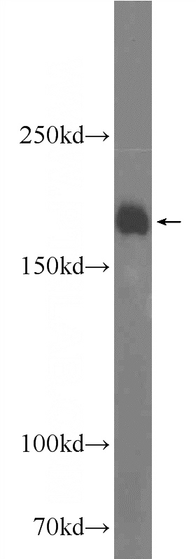 mouse brain tissue were subjected to SDS PAGE followed by western blot with Catalog No:108236(ARAP2 Antibody) at dilution of 1:600