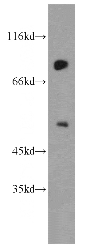 MCF7 cells were subjected to SDS PAGE followed by western blot with Catalog No:116687(USP49 antibody) at dilution of 1:1000
