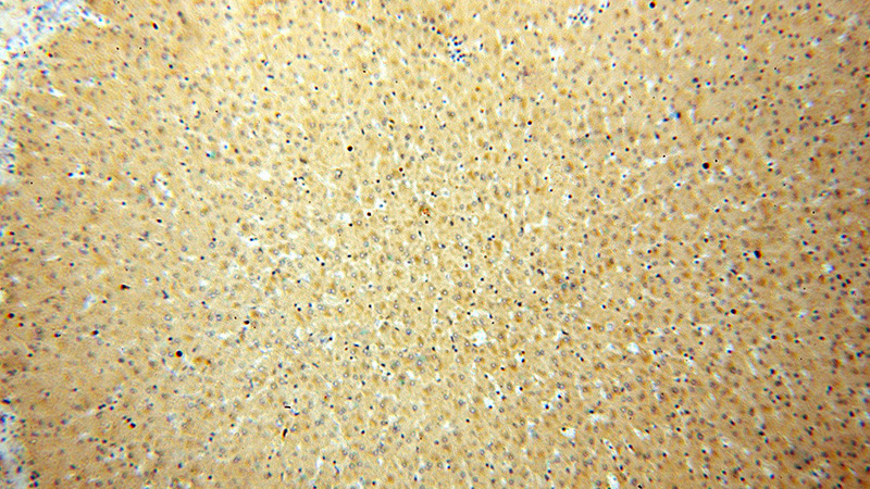 Immunohistochemical of paraffin-embedded human liver using Catalog No:108031(APOF antibody) at dilution of 1:50 (under 10x lens)