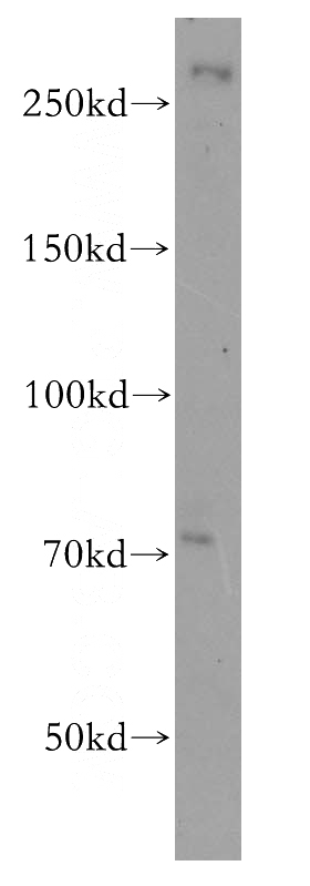 HeLa cells were subjected to SDS PAGE followed by western blot with Catalog No:113188(NIPBL antibody) at dilution of 1:800