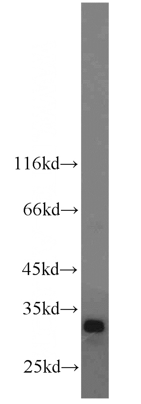 MDA-MB-453s cells were subjected to SDS PAGE followed by western blot with Catalog No:109664(CCND3 antibody) at dilution of 1:500