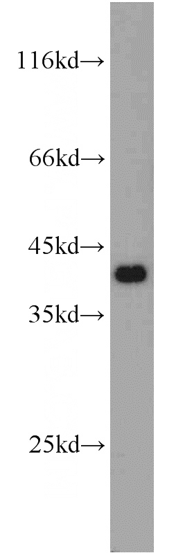 A2780 cells were subjected to SDS PAGE followed by western blot with Catalog No:113053(NDE1 antibody) at dilution of 1:1500