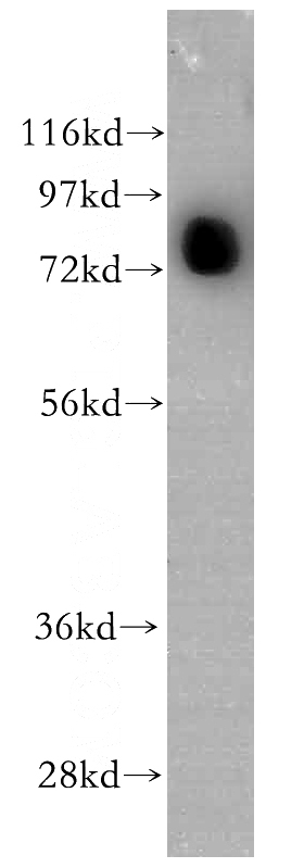 HEK-293 cells were subjected to SDS PAGE followed by western blot with Catalog No:107928(AKAP10 antibody) at dilution of 1:500