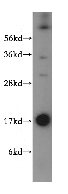mouse brain tissue were subjected to SDS PAGE followed by western blot with Catalog No:116520(UBE2D4 antibody) at dilution of 1:500
