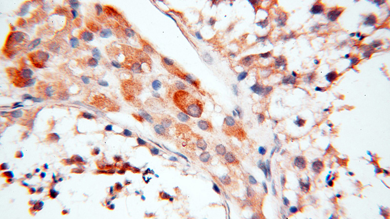 Immunohistochemical of paraffin-embedded human testis using Catalog No:107932(AKAP3 antibody) at dilution of 1:100 (under 40x lens)