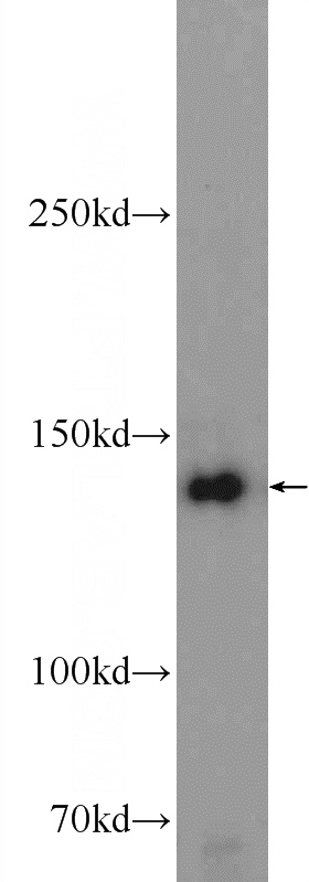 HEK-293 cells were subjected to SDS PAGE followed by western blot with Catalog No:115258(SKIV2L Antibody) at dilution of 1:600