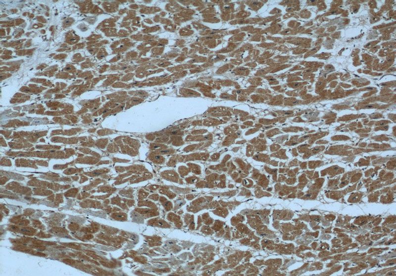 Immunohistochemical of paraffin-embedded human heart using Catalog No:113901(PIK3C2A antibody) at dilution of 1:50 (under 10x lens)