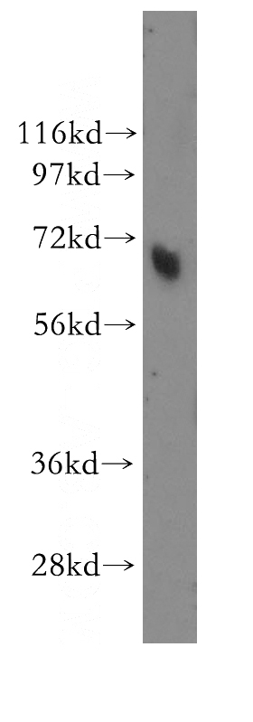 human skin tissue were subjected to SDS PAGE followed by western blot with Catalog No:112504(MBD4 antibody) at dilution of 1:500