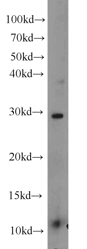 K-562 cells were subjected to SDS PAGE followed by western blot with Catalog No:116016(TFPT antibody) at dilution of 1:600