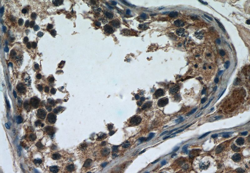 Immunohistochemistry of paraffin-embedded human testis tissue slide using Catalog No:116856(WDR16 Antibody) at dilution of 1:50 (under 40x lens)