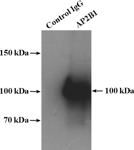 IP Result of anti-AP2B1 (IP:Catalog No:108120, 4ug; Detection:Catalog No:108120 1:500) with K-562 cells lysate 3200ug.