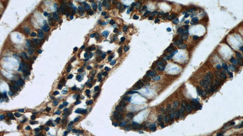 Immunohistochemistry of paraffin-embedded human small intestine tissue slide using Catalog No:117196(BMP2 Antibody) at dilution of 1:50 (under 40x lens)