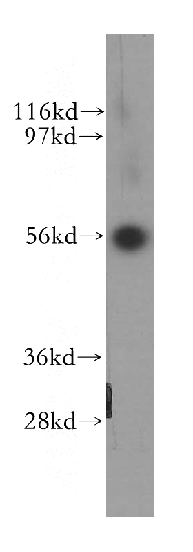 A549 cells were subjected to SDS PAGE followed by western blot with Catalog No:116392(TFG antibody) at dilution of 1:400