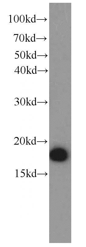 HEK-293 cells were subjected to SDS PAGE followed by western blot with Catalog No:115492(SOD1 antibody) at dilution of 1:1500