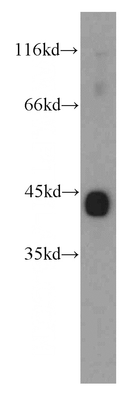 mouse heart tissue were subjected to SDS PAGE followed by western blot with Catalog No:107863(ACTC1 antibody) at dilution of 1:800