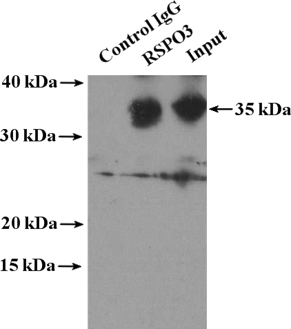IP Result of anti-RSPO3 (IP:Catalog No:114852, 4ug; Detection:Catalog No:114852 1:300) with human placenta tissue lysate 2800ug.
