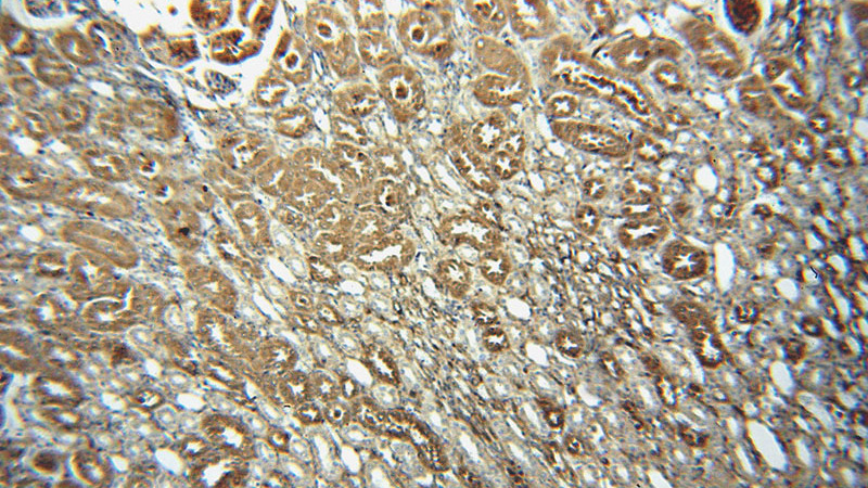 Immunohistochemical of paraffin-embedded human kidney using Catalog No:109573(DPYSL3 antibody) at dilution of 1:100 (under 10x lens)