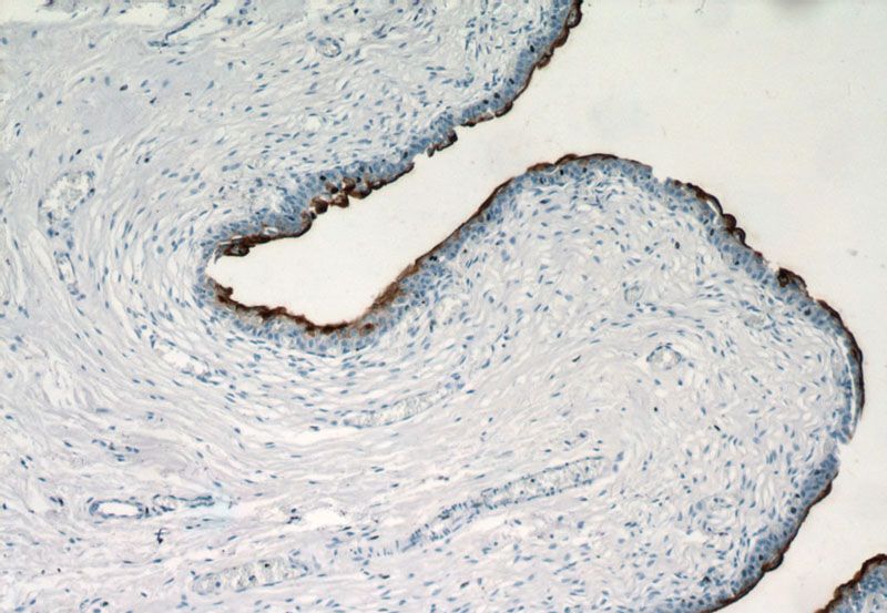 Immunohistochemistry of paraffin-embedded human bladder tissue slide using Catalog No:116631(UPK3B Antibody) at dilution of 1:100 (under 10x lens)