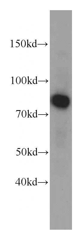 human brain tissue were subjected to SDS PAGE followed by western blot with Catalog No:109372(COIL antibody) at dilution of 1:800