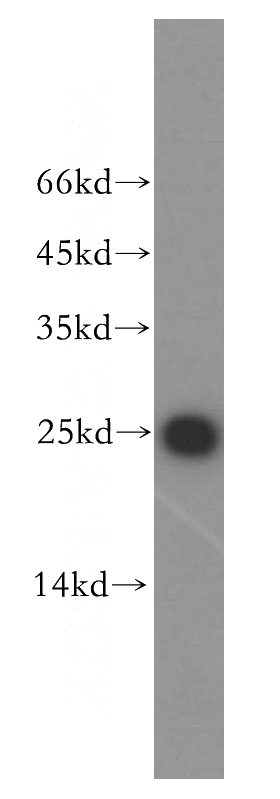 mouse testis tissue were subjected to SDS PAGE followed by western blot with Catalog No:116050(THoc7 antibody) at dilution of 1:800