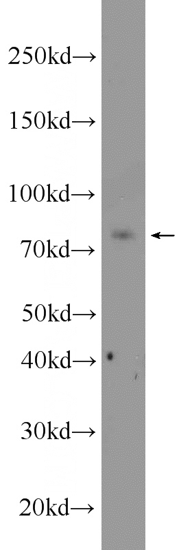 human testis tissue were subjected to SDS PAGE followed by western blot with Catalog No:108970(CCDC27 antibody) at dilution of 1:600
