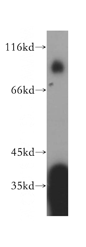 human placenta tissue were subjected to SDS PAGE followed by western blot with Catalog No:113147(NFE2L3 antibody) at dilution of 1:500