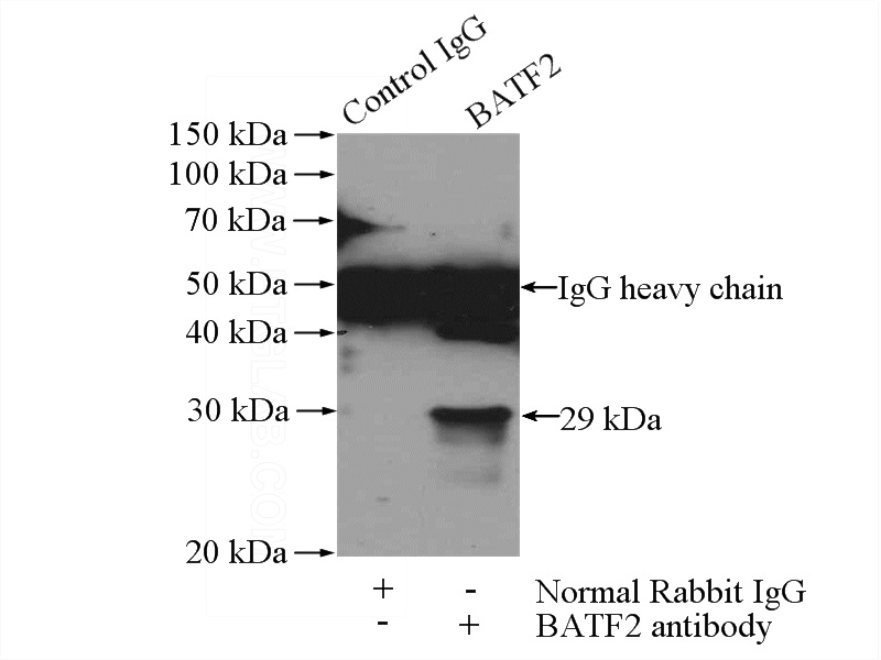 IP Result of anti-BATF2 (IP:Catalog No:108363, 3ug; Detection:Catalog No:108363 1:300) with HeLa cells lysate 1200ug.