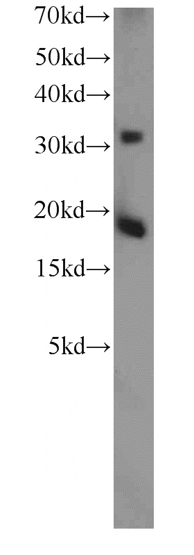 human brain tissue were subjected to SDS PAGE followed by western blot with Catalog No:116423(TSC22D1 antibody) at dilution of 1:1000