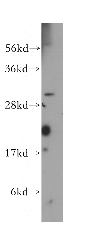 mouse ovary tissue were subjected to SDS PAGE followed by western blot with Catalog No:114795(RPAIN antibody) at dilution of 1:300